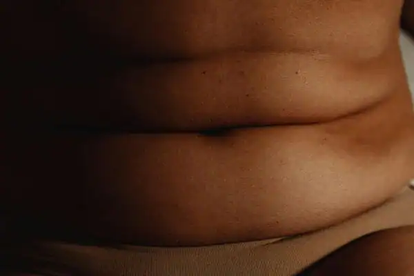 The Hidden Connection: How Stress Shapes Your Fitness and Body Composition 3 image of what stress can do on the stomach area and how Lipo 360 Frimley can help to change your body shape.